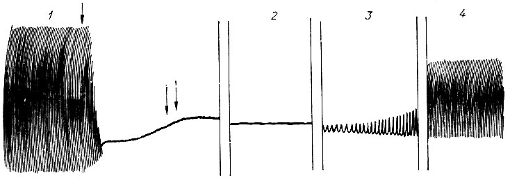 57. Влияние хлороформа на работу изолированного сердца лягушки (по В. И. Скворцову): 1 - пропускание хлороформа в концентрации 1:2000 (показано одной стрелкой) и отмывание раствором Рингера (две стрелки); 2 - после 35 с отмывания; 3 - к концу 1 мин; 4 - через 4 мин после отмывания