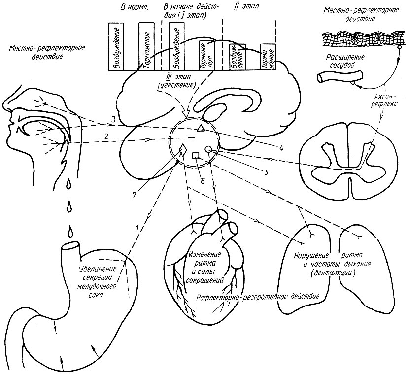 70. Схема рефлекторнорезорбтивного действия этилового спирта: 1 - блуждающий нерв и его ядро (7); 2 - верхний гортанный нерв; 3 - тройничный нерв и его ядро (4); 5 - сосудодвигательный центр; 6 - дыхательный центр