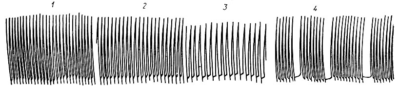 183. Кривая сокращений изолированного сердца кролика под влиянием пилокарпина (по Н. П. Кравкову): 1 - исходные сокращения; 2 - через 2 мин от начала пропускания раствора пилокарпина гидрохлорида в концентрации 1:50000; 3 - через 5 мин; 4 - через 12 мин (периодические сокращения)
