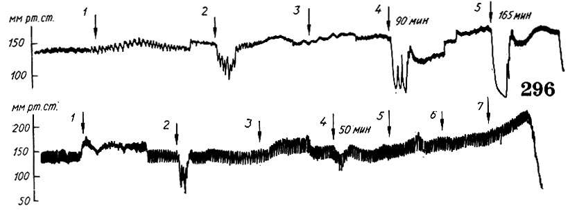 297. Влияние больших доз конваллятоксина на артериальное давление собаки (по П. И. Оницеву): 1 - перерезка блуждающего нерва (указано стрелкой); 2, 4, б, 7 - раздражение нерва электрическим током; 3, 5 - введение конваллятоксина (0,05 мг/кг)