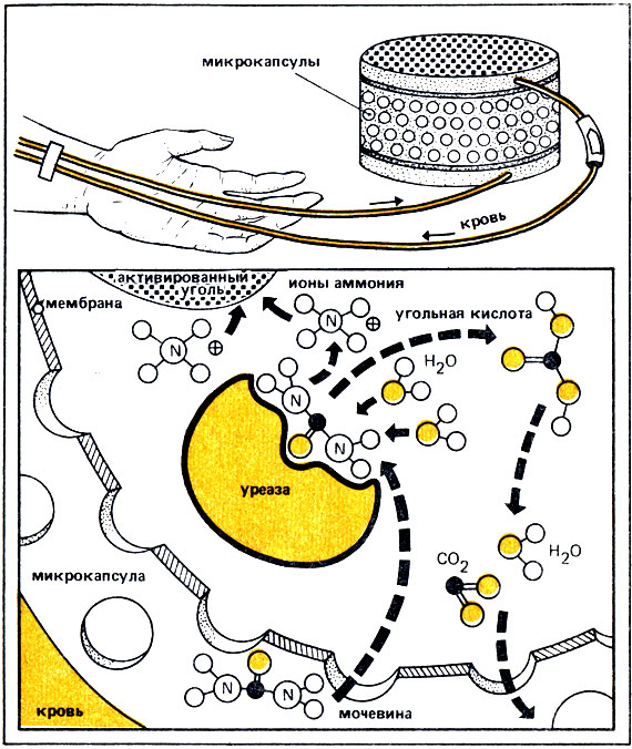 Рис. 37. Принцип ферментативного расщепления мочевины микрокапсулированной уреазой с использованием искусственной почки, разработанной проф. Чангом